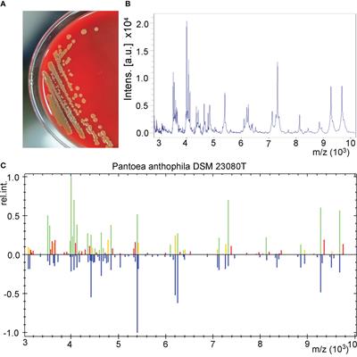 Genomic characterization of Pantoea anthophila strain UI705 causing urinary tract infections in China